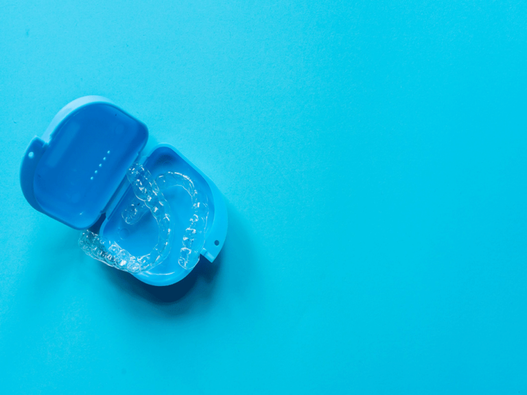 A clear dental aligner placed inside an open blue plastic case, showcasing the aligner's shape and transparency.