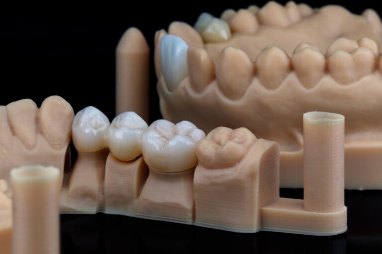 Dental model displaying upper and lower arches with realistic artificial teeth, including crowns or implants; mounted on a gum-colored base with cylindrical supports for stability and fabrication.